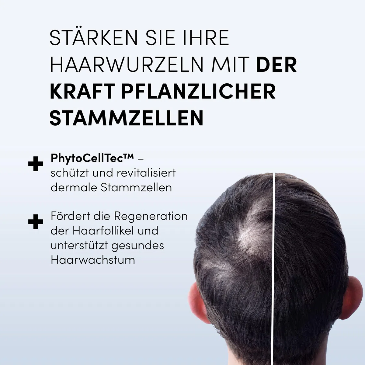 Dr. Balwi Anti-Haarausfall Serum mit Procapil & AnaGain, stärkt Haarwurzeln, fördert Haarwachstum, mit Biotin & Stammzellen, ohne Silikone & Parabene, 5x6ml Flacon