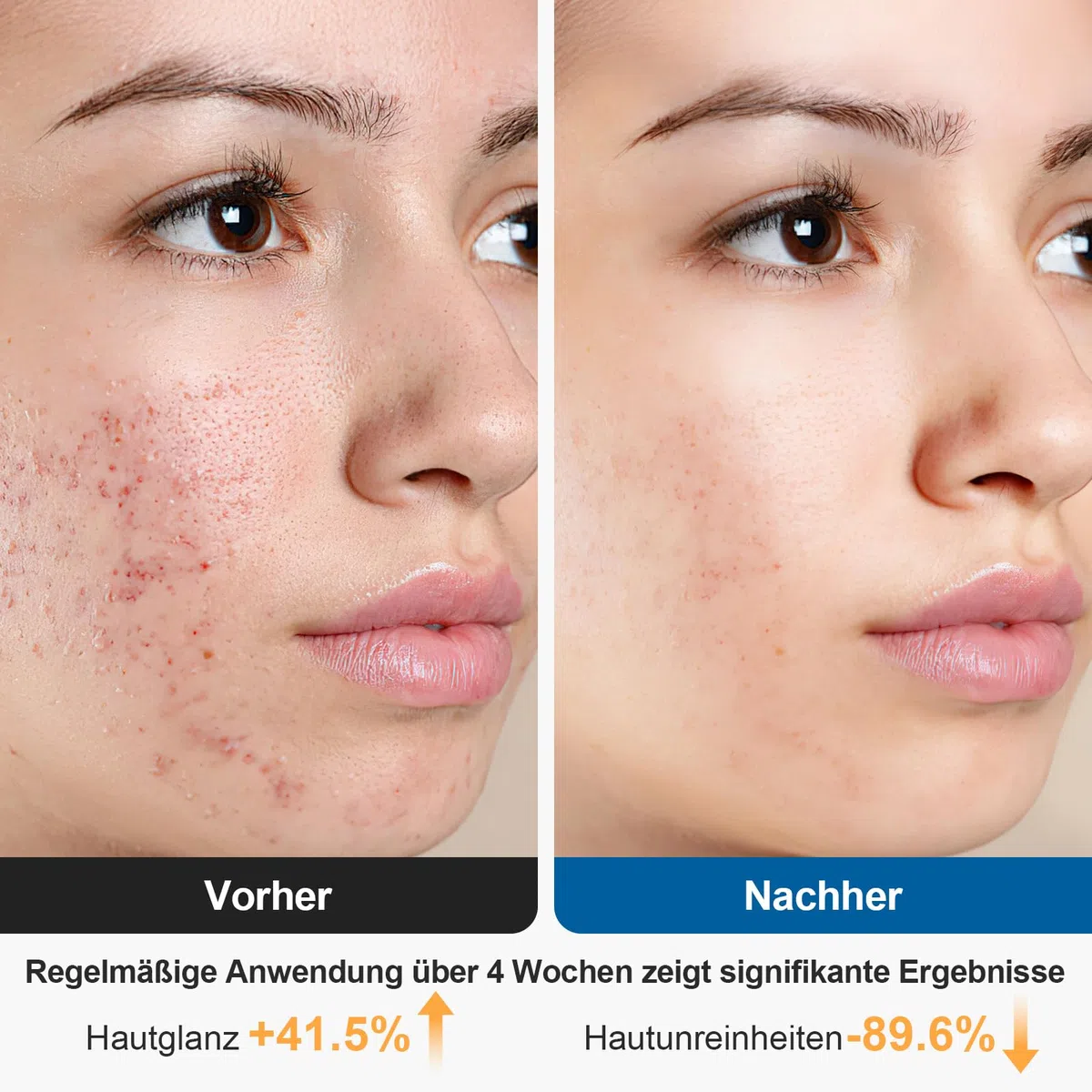 Elektrische Gesichtsreinigungsbürste, 2 in 1 Gesichtsbürste Mit 4 Bürstenköpfen, EMS Gesichtsmassagegerät mit Heizung Wasserdichte Gesichtsreinigung Tiefenreinigung für alle Hauttypen (Rosa)