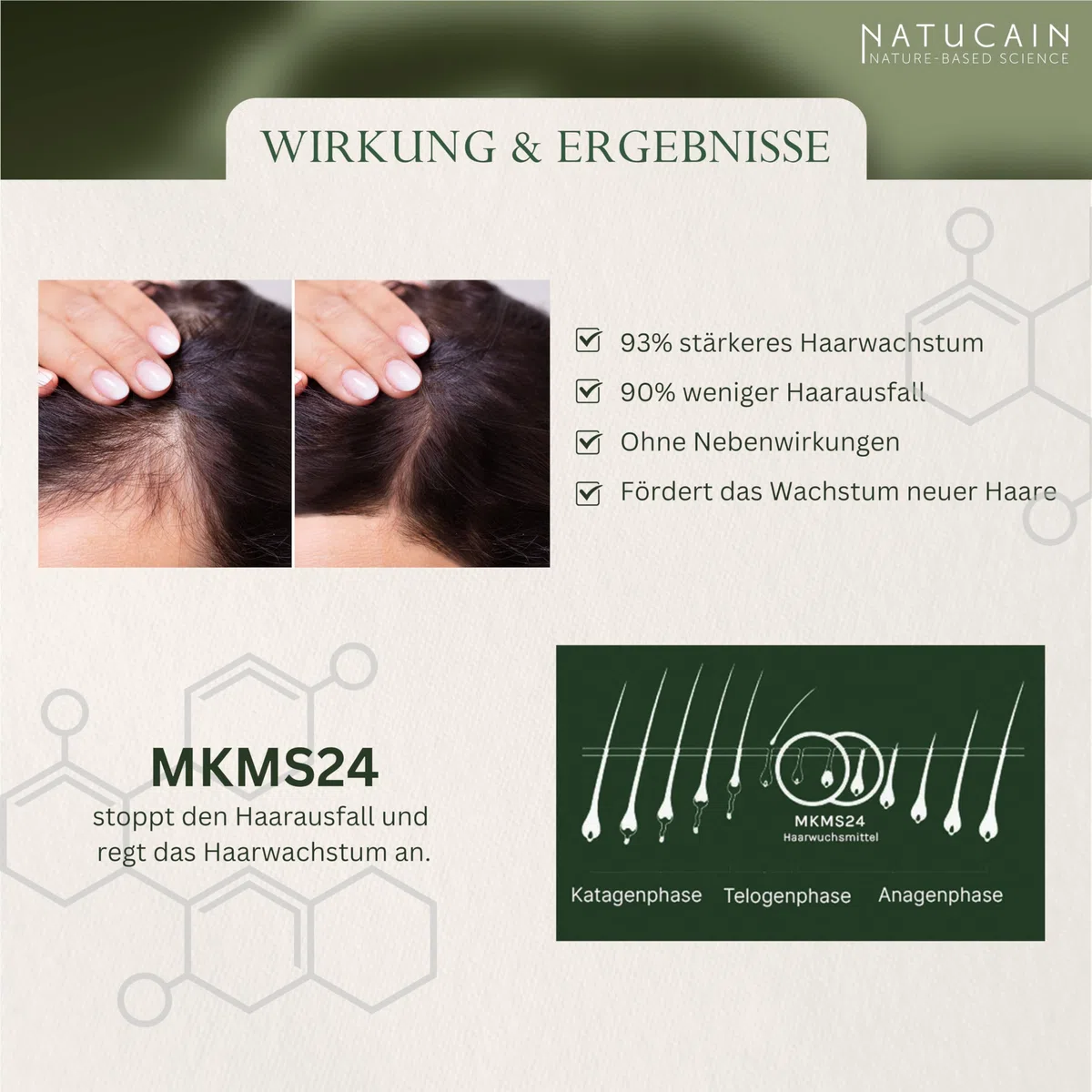 Testsieger Haarserum gegen Haarausfall Natucain | Aktiviert Haarwuchs & Anti Haarausfall | Hormonfreies Haarwuchsmittel für Frauen und Männer | Made in Germany | 200 ml…