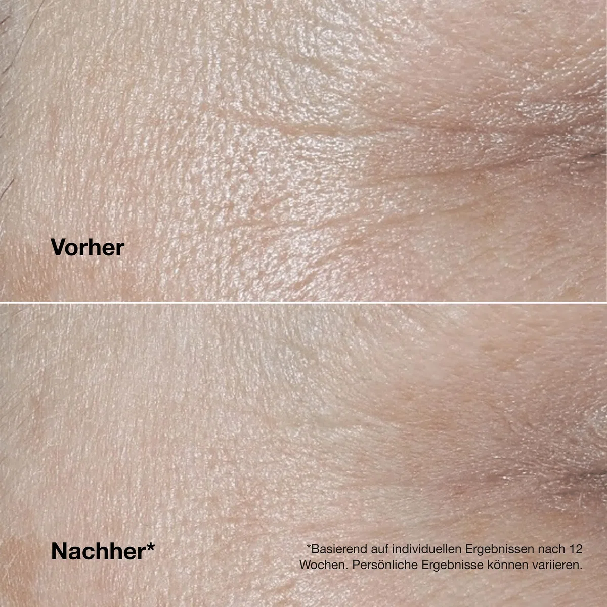 Clinique Smart Clinical Repair™ Wrinkle Correcting Cream | Mit Peptiden und Hyaluronsäure | Anti-aging + feuchtigkeitsspendend