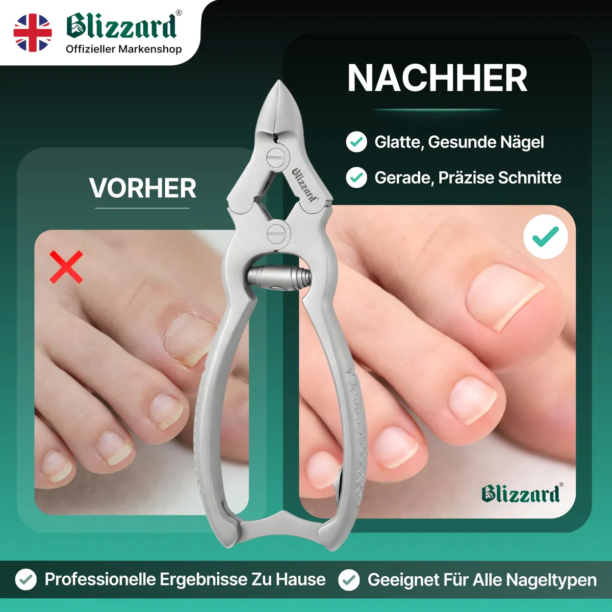 Blizzard Nagelzange für Fußnägel – Extra starke Fußnagelzange für dicke, harte & eingewachsene Zehennägel – Profi Pediküre Fußpflege Werkzeug aus Edelstahl inkl. Nagelfeile – 15 cm Pufferfeder