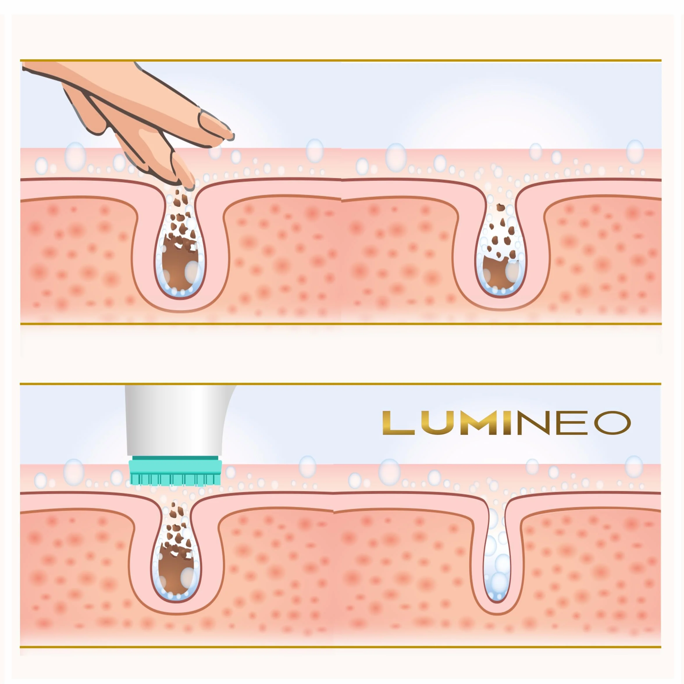 LUMINEO PRO Gesichtsreinigungsbürste & Gesichtsmassagegerät Set mit Gel – Elektrische Gesichtsbürste für Tiefenreinigung, Anti-Aging & Mitesser, USB (Türkis/Normale Haut)