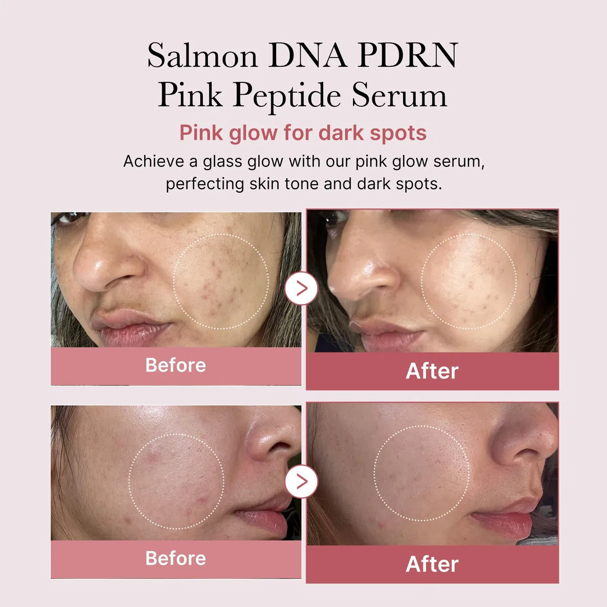 Medicube Synergie-Duo Zero Pore Pads 70 Pads & PDRN Pink Peptide Serum 30ml Korean Skincare Pflegeset