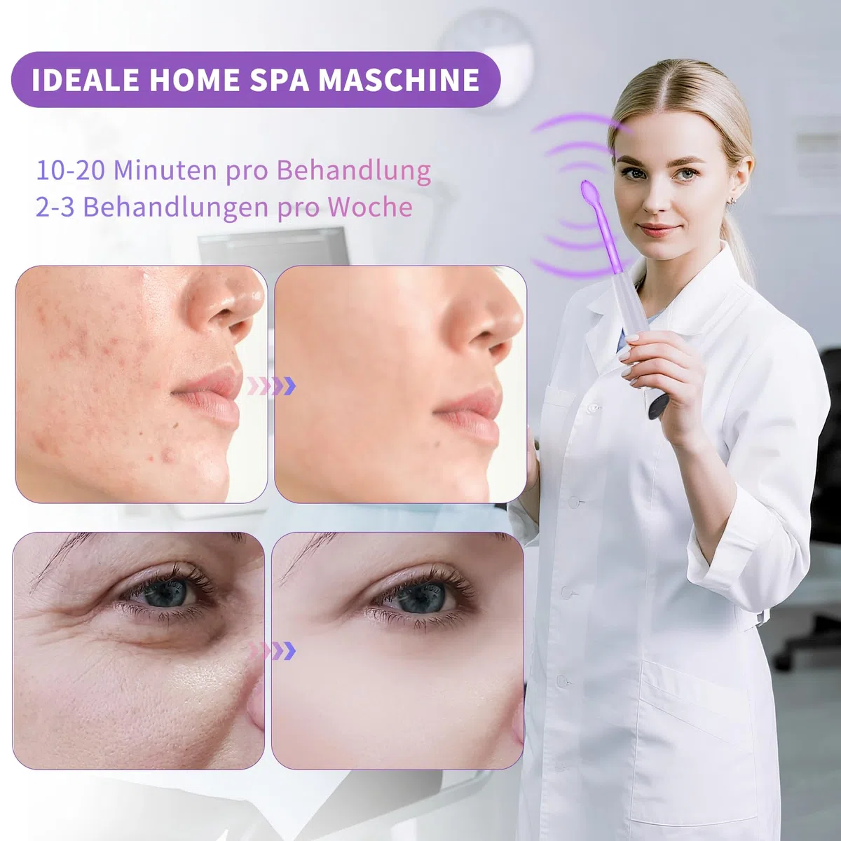 Hochfrequenzstab, iklestar Hochfrequenz Gerät Haare Kit mit Argon Neon Röhren, Professionelle Gesichts-Gerät für Hautpflege Home verwenden