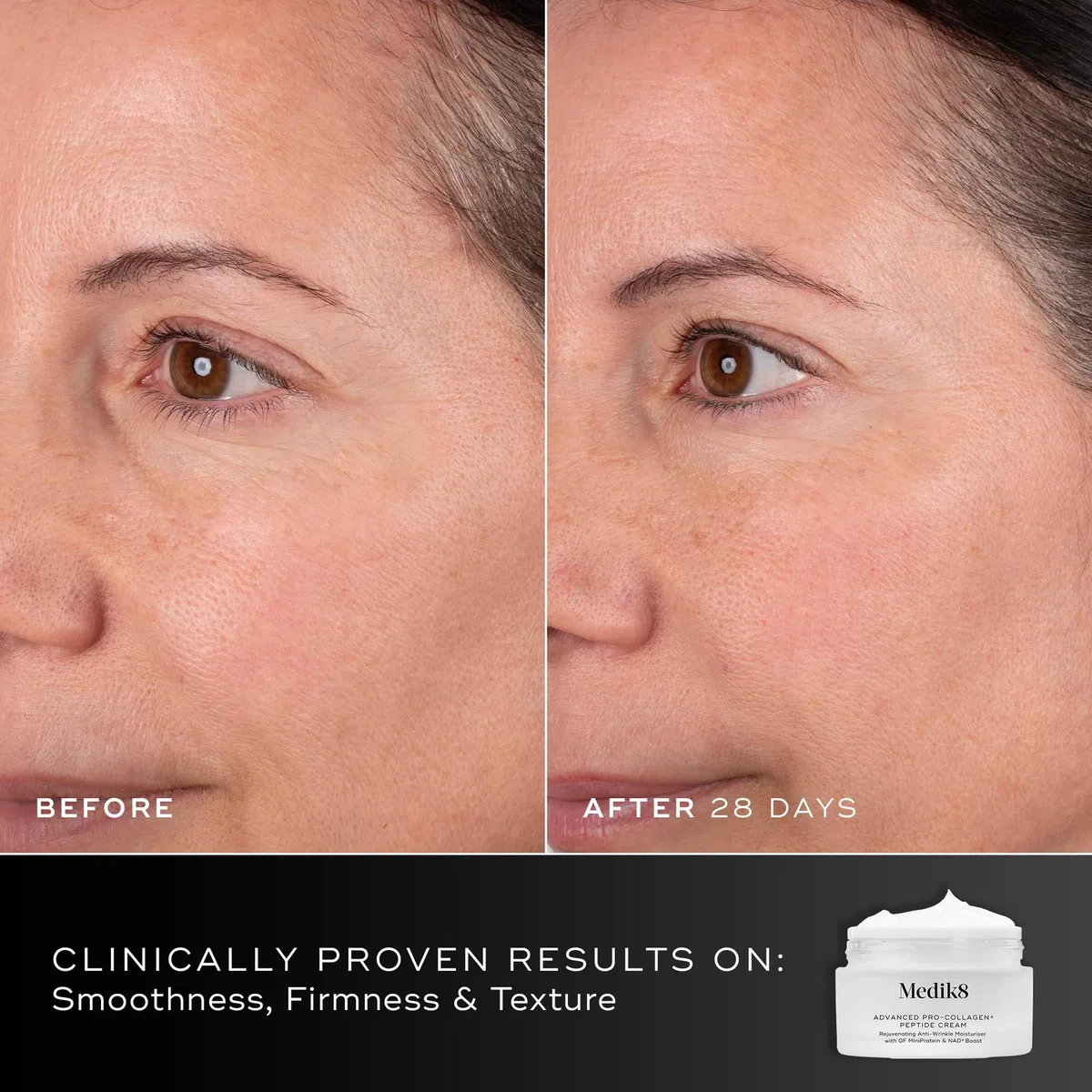 Medik8 Advanced Pro-Collagen+ Peptide Cream – Verjüngende Anti-Falten-Feuchtigkeitscreme mit Growth Factor MiniProtein & NAD+ Langlebigkeits-Booster - 50ml | Verjüngende Anti-Falten-Feuchtigkeitspflege mit Wachstumsfaktor MiniProtein & NAD+ Longevity Boos