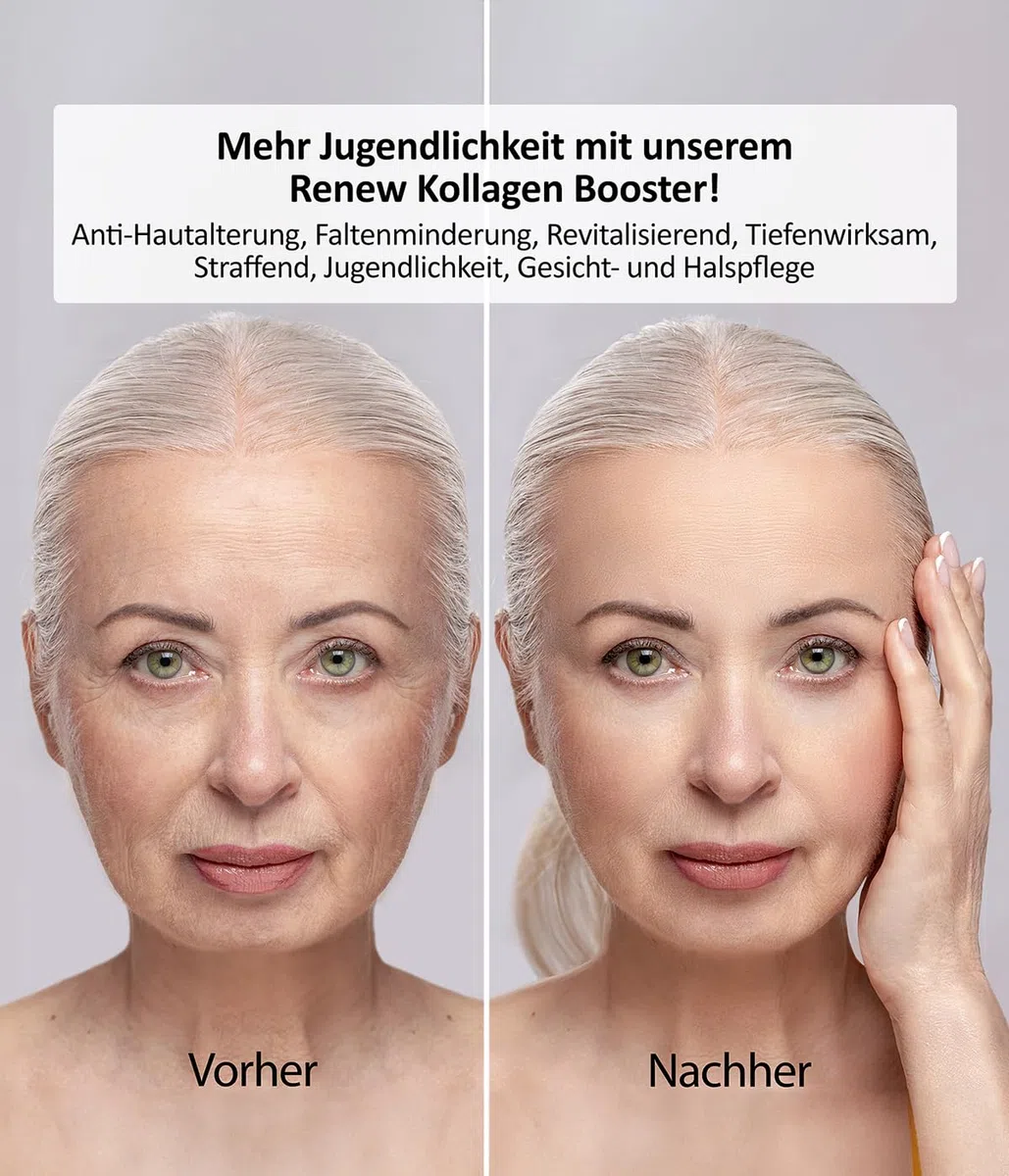 Genius Velform Renew Kollagen Booster Gesichtsmaske Set 22 tlg, Collagen Gesicht Anti Aging Maske für die Schönheit, Kollagen Patches mit Spray