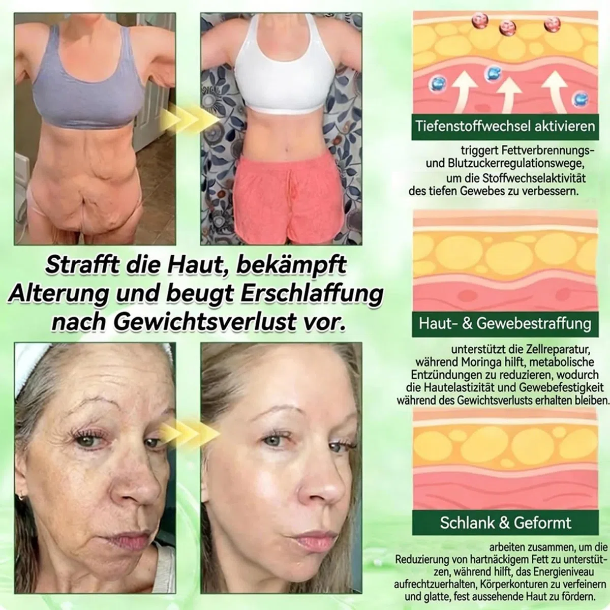 Surgonix Moringa 10-IN-1 Fortschrittlichesich Nano-Mikronadel-Pflaster, Natürliche Abnehmpflaster, Surgonix Moringa Pflaster, Sanfte Beruhigung für alle Körpertypen (4 Stück)