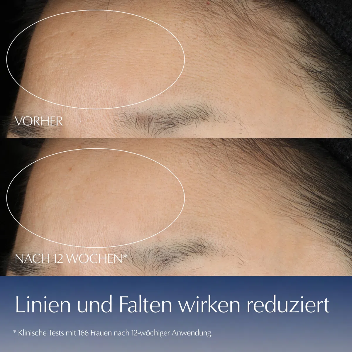 Estée Lauder Advanced Night Repair Synchronized Multi-Recovery Complex | Gesichtsserum mit Hyaluron & Peptiden | Für glattere, strahlendere & ebenmäßigere Haut | Für jeden Hauttyp, 50ml