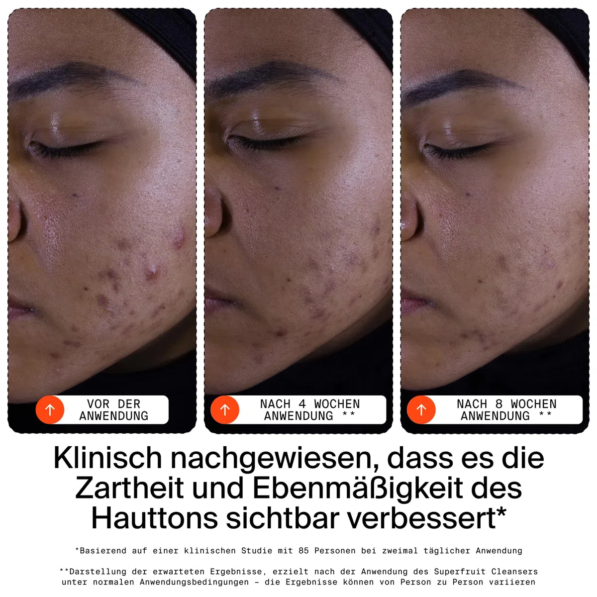 Youth To The People Superfruit Cleanser, sanfter Peeling-Gesichtsreiniger, mit Papaya und Vitamin C, beruhigender Reiniger, feuchtigkeitsspendend, schont die Hautbarriere, Make-up-Entferner