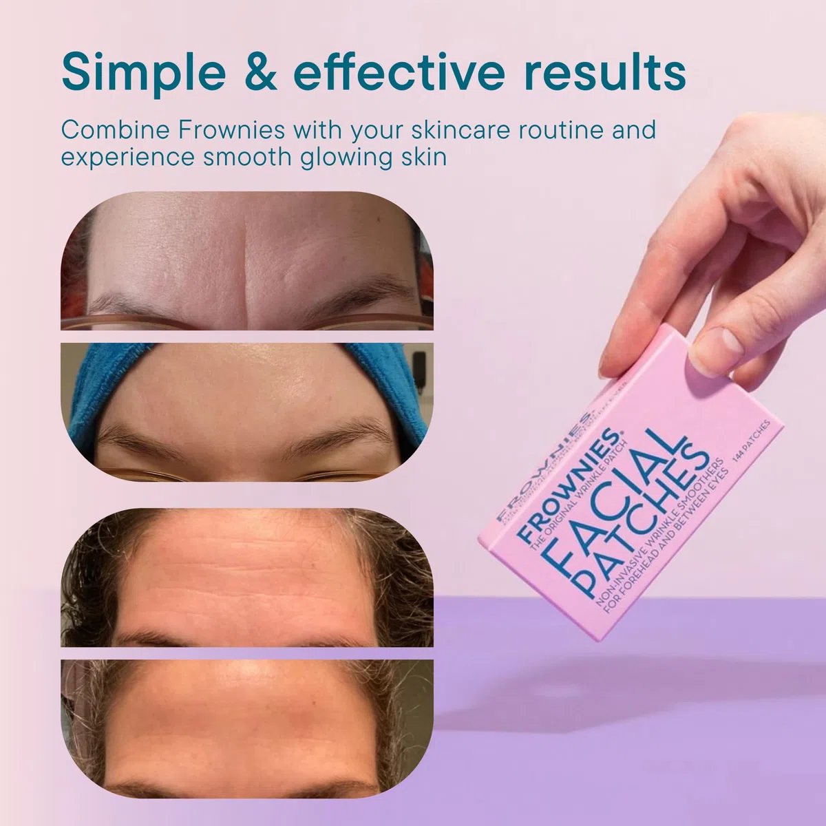 Frownies Facial Patches for forehead and Between Eyes 144 stuks
