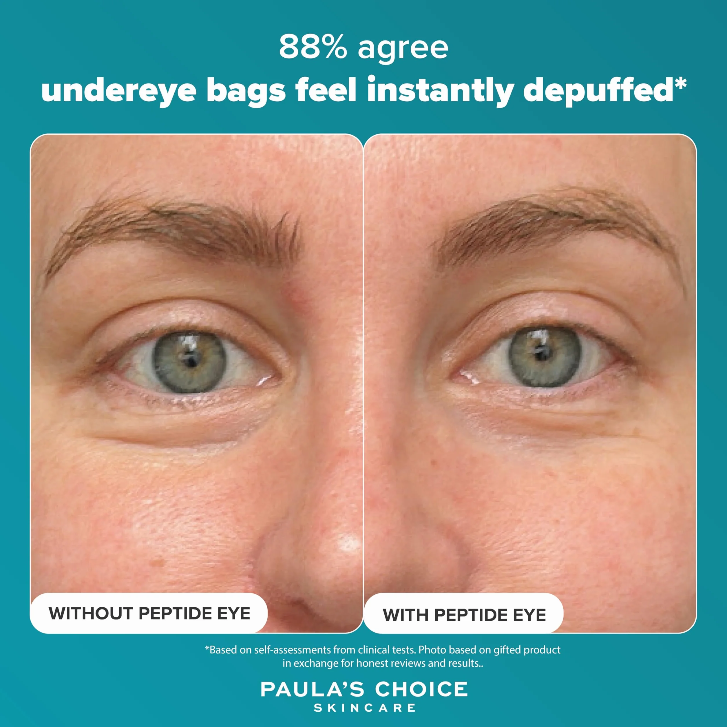 Paula's Choice Pro-Collagen Peptide Straffendes Augenserum, 15 ml | Anti-Aging Peptide Augenserum - Reduziert Schwellungen & Spendet Feuchtigkeit - Leichte Gel-Serum - Metallapplikator