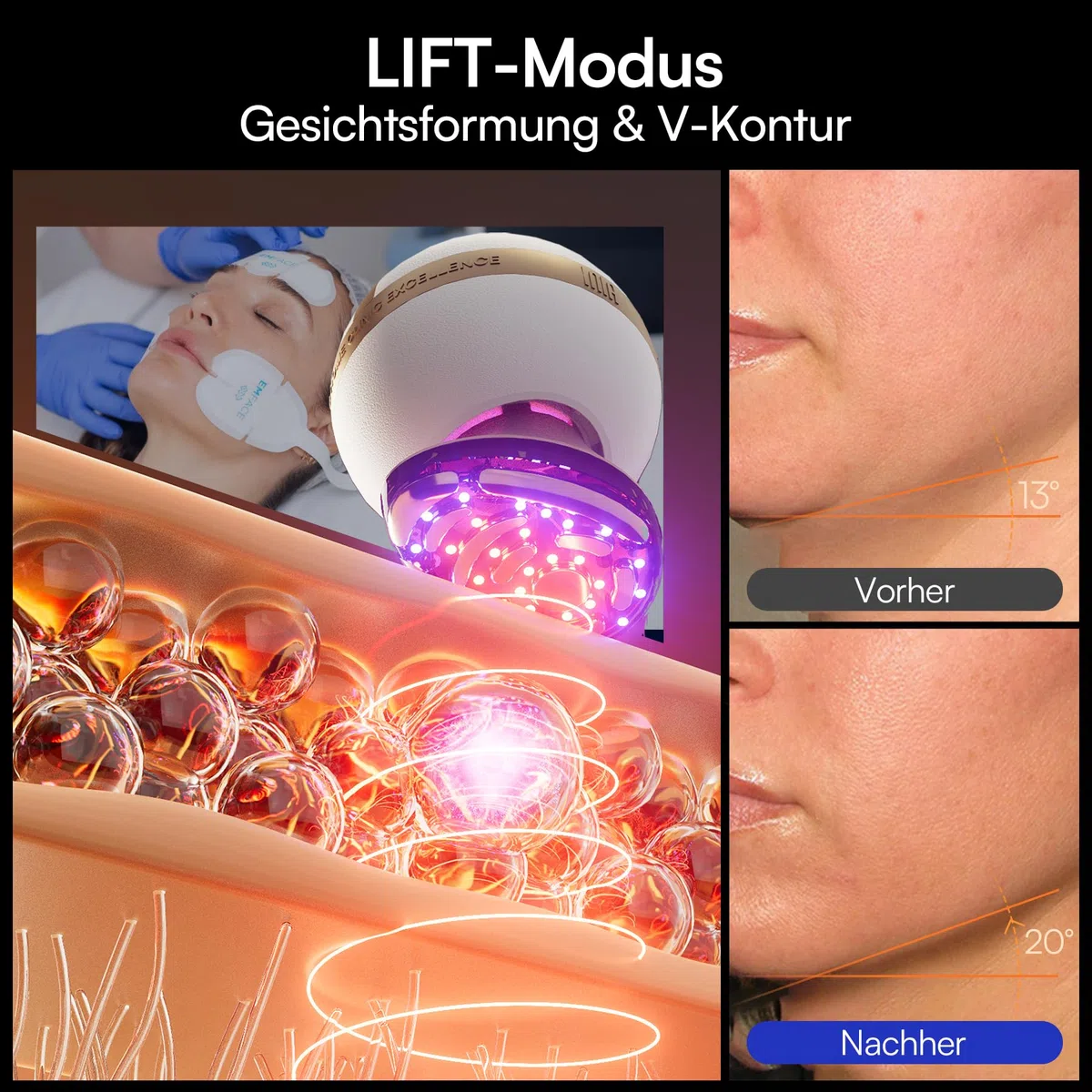 INIA SPHERA Verbesserter 8-in-1 Mikrostrom-Gesichtsmassager für Gesicht & Hals – Rotlicht, Wärme- & Kühlfunktion, 5 Modi, Beauty-Tool für definierte und strahlende Haut zu Hause