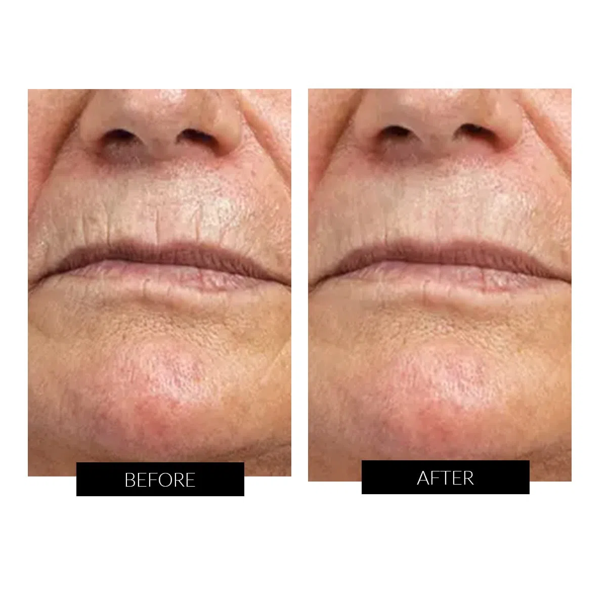 CurrentBody Haut-Radiofrequenzgerät | Gesichtstonungsgerät | Klinisch bewährte Technologie zur Hautstraffung und Anti-Aging