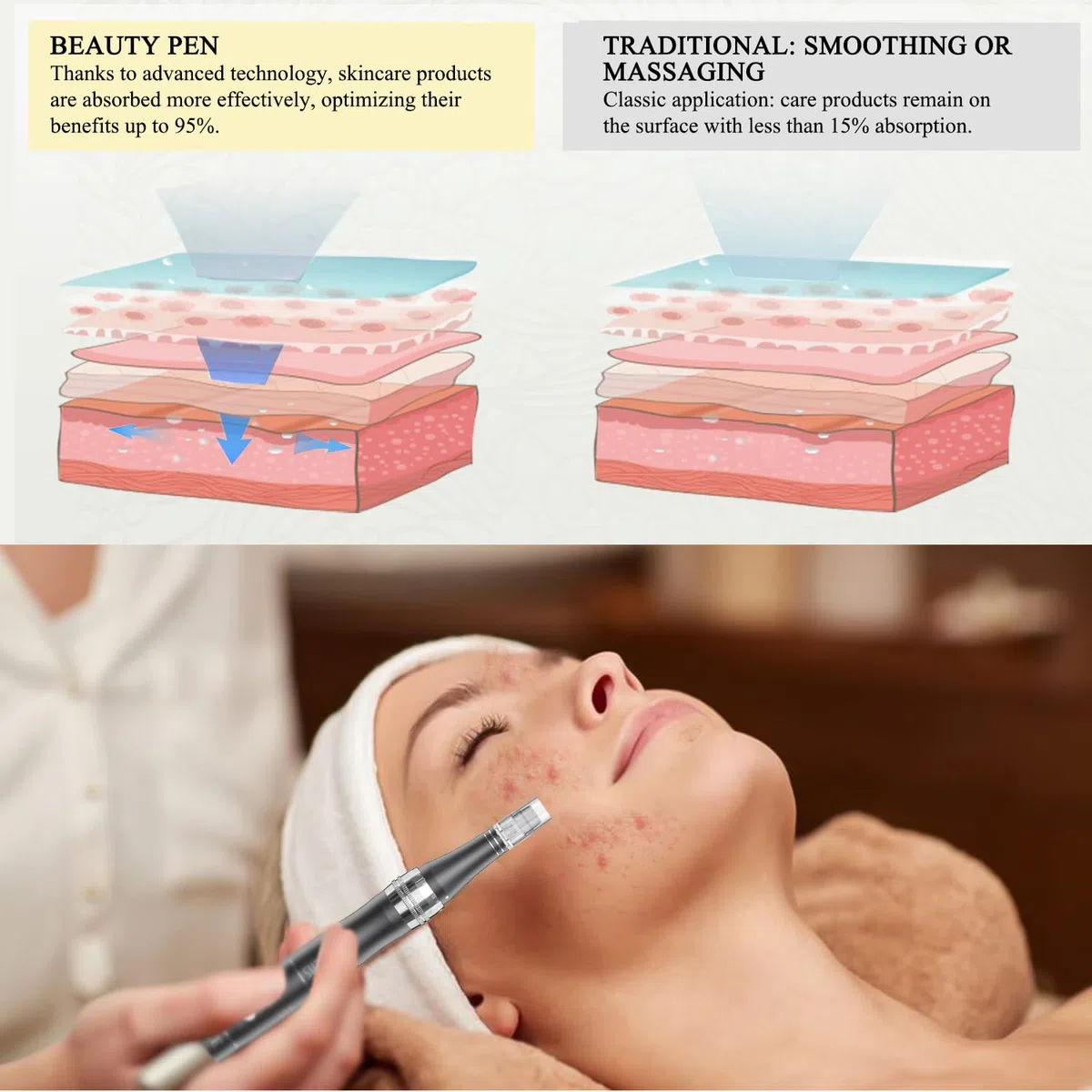 PELCAS Derma pen Elektrischer Mikroneedling Schönheit Pen Mikronadelstift Wiederaufladbar Verstellbar Länge mit 3 Geschwindigkeiten 12 Ersatzköpfe Tragbares Microneedling Gerät für Gesicht Haut Grau