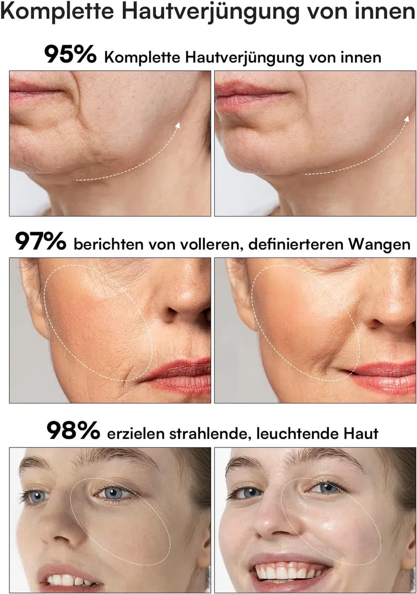 INIA Professionelles 3-in-1 Anti-Falten Gesichtsmassagegerät mit Mikrostrom & Rotlicht Straffendes Lifting-Gerät für Gescht/Hals, Reduziert Schwellungen & Falten Firm