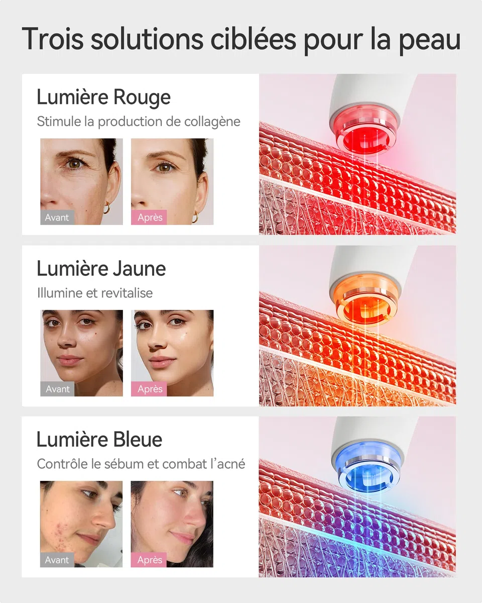 FliKEZE Gesichtsmassagegerät mit Vakuum & Rotlicht, 3-in-1 Beauty Gerät für Gesicht und Hals | Elektrisches Gesichtspflegegerät mit LED-Licht, 3 Intensitätsstufen und einfacher Anwendung für die tägliche Beauty-Routine