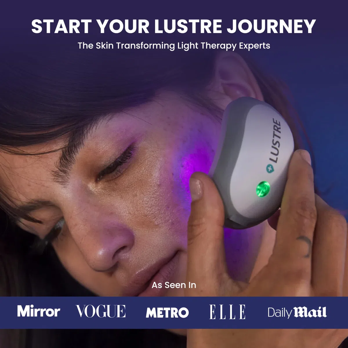 LUSTRE Solo Blue Light Akne-Behandlungsgerät, UV-frei & drahtlos | Für Akne, Pickel und Unreinheiten