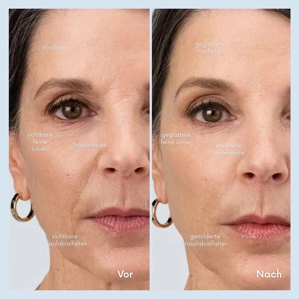 luxxiv FacialWand | Schaffen Sie eine festere, glattere und strahlendere Haut Elektrische Gesichtsreinigungsbürste – Multifunktionaler Peeling-Massagegerät für alle Hauttypen