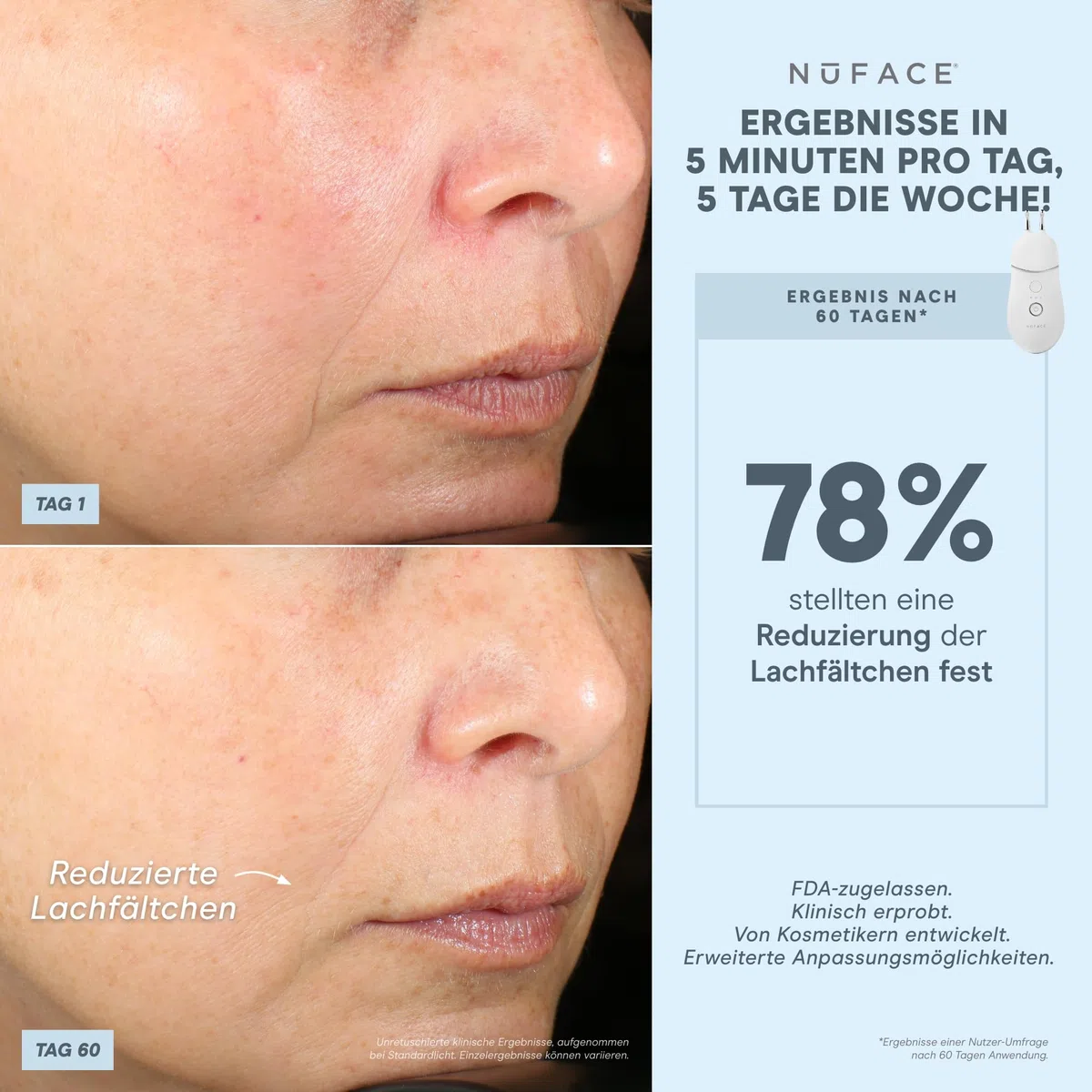 NuFACE TRINITY+ Lip & Eye Attachment