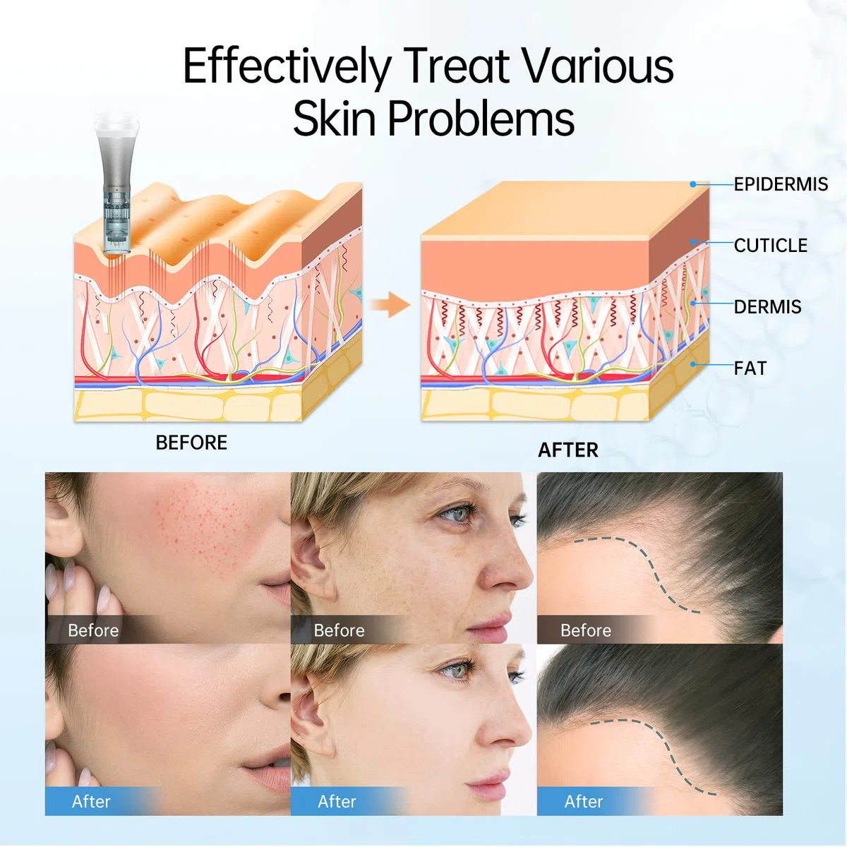 Dr.Pen M8 Microneedling Pen Wireless Micro Needling Device for Face Body Acne Scars Wrinkles with 10 Replacement Cartridges