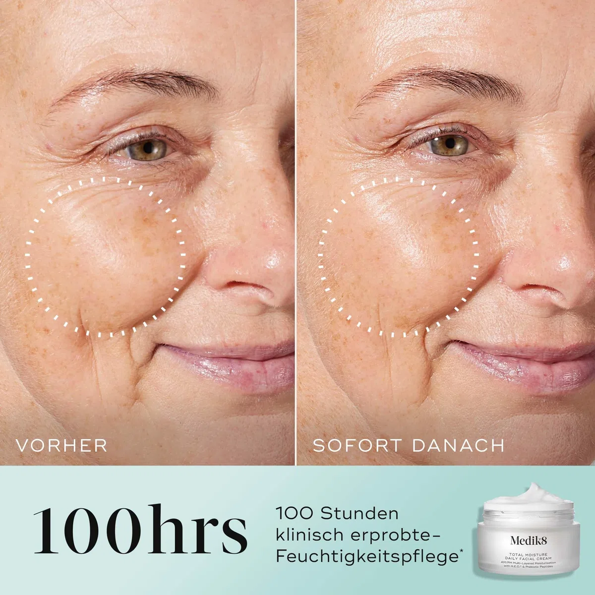 Medik8 Total Moisture Daily Facial Cream, Feuchtigkeitscreme - 50 ml | Mehrschichtige Feuchtigkeitspflege, Tag & Nacht, H.E.O. & präbiotische Peptiden, 100 Std. Feuchtigkeit, für die Hautbarriere