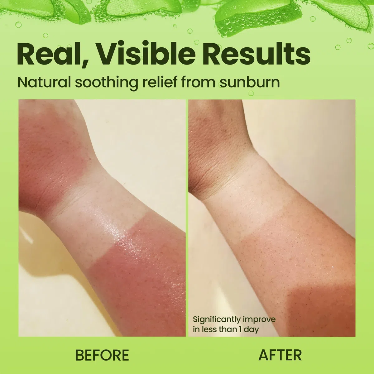 Honeyskin Aloe Vera Gel