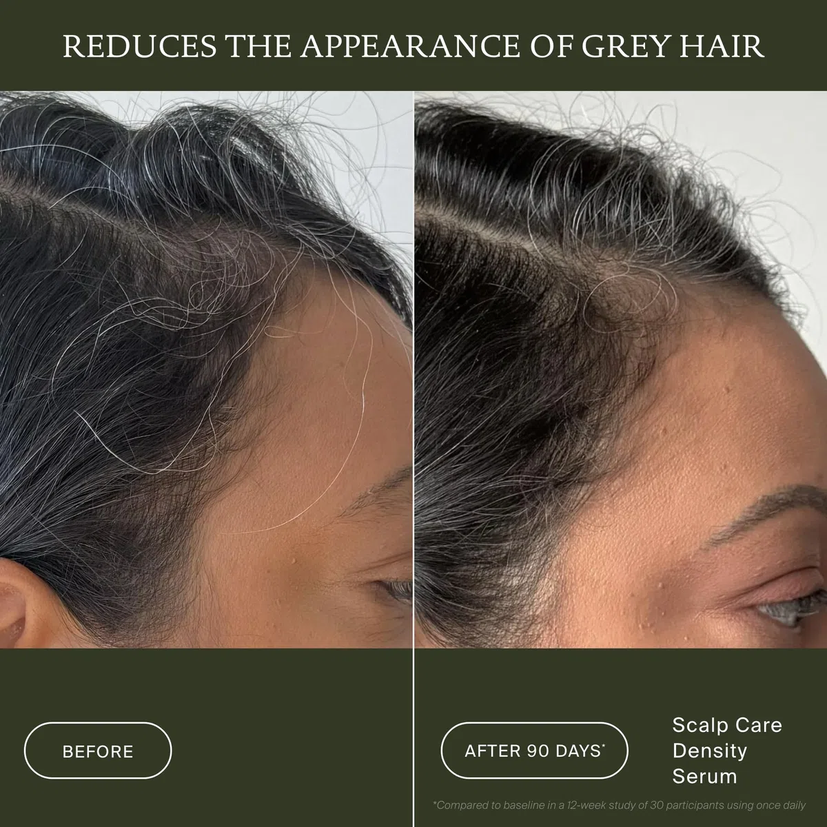 Living Proof Scalp Care Density Serum (50ml) – Serum für gesunde Kopfhaut & Haardichte – Gegen Haarausfall & graues Haar – Schnell einziehend & nicht ausspülbar – Für volleres, kräftigeres Haar