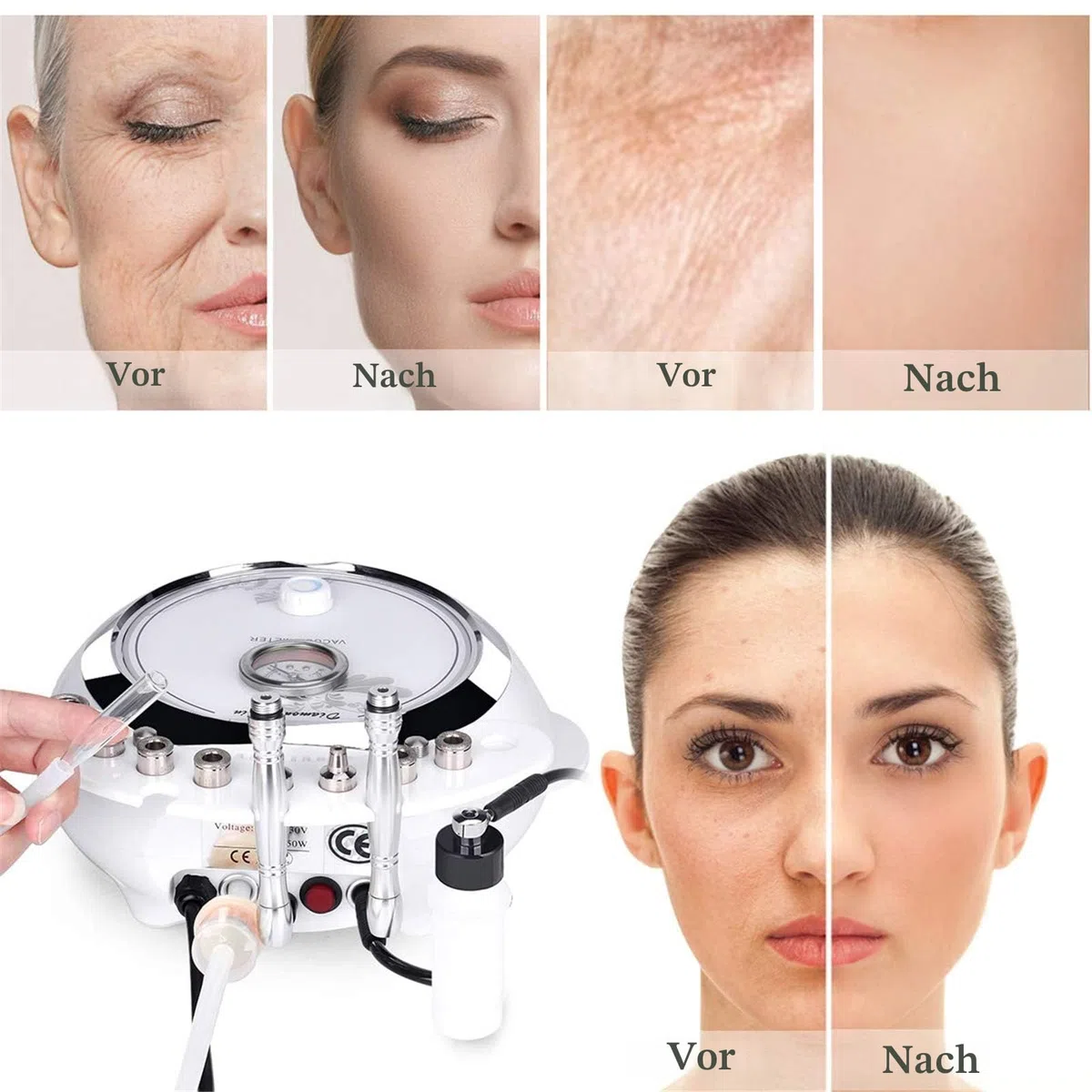 TwoWin Diamant Mikrodermabrasion Dermabrasion Maschine, 3 in 1 Professionelle Hautverjüngung Akne Faltenbehandlung Salonausstattung für Gesicht mit Vakuum und Spray (Starke Saugkraft: 65-68 cmhg)