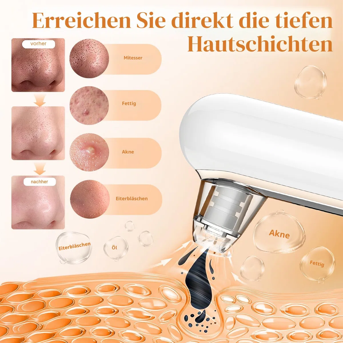 Yccu Mitesserentferner Porenreiniger 4 Modi Vakuumsauger Gesichtsreinigung Akne Behandlung