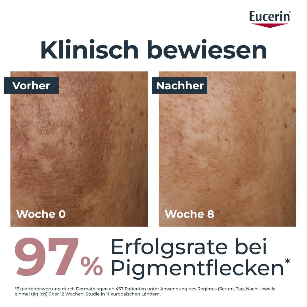 Eucerin Anti-Pigment Dual Serum 30 ml, Gesichtsserum | Reduziert sichtbar Pigmentflecken, Verleiht einen gleichmäßigen Hautton, Mit Thiamidol & Hyaluronsäure