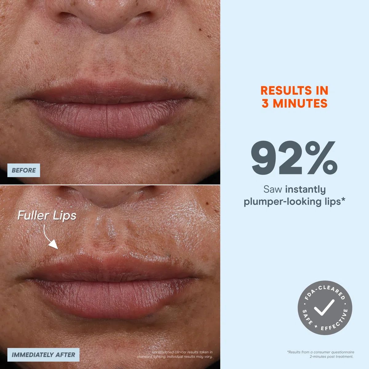 NuFACE FIX MicroWand - Microcurrent Device + Serum Activator for On-The-Go Treatment of Forehead Lines, Crow's Feet, Under Eyes, Smile Lines & Fuller-Looking Lips