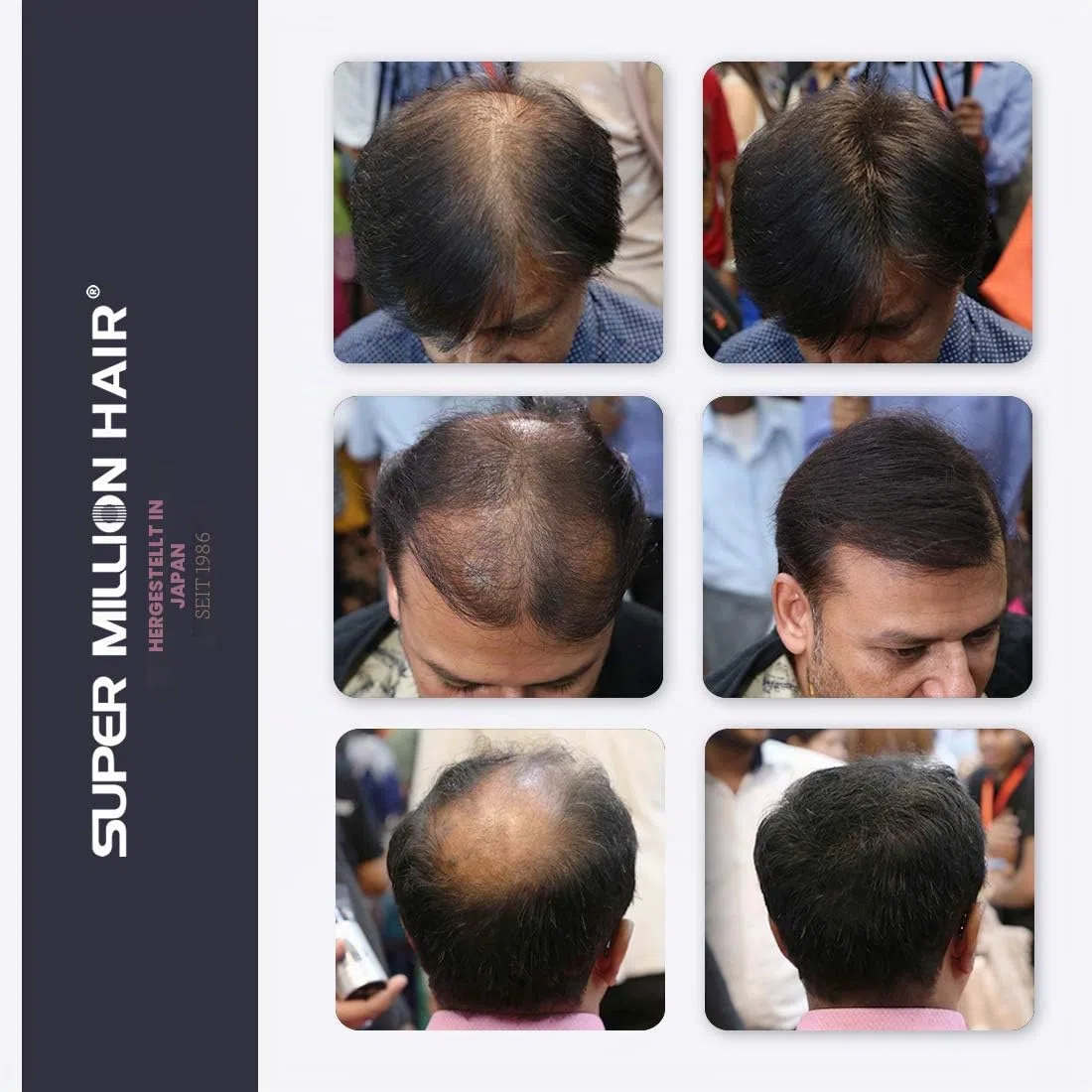 Super Million Hair 15g Hair Fibres - Medium Brown