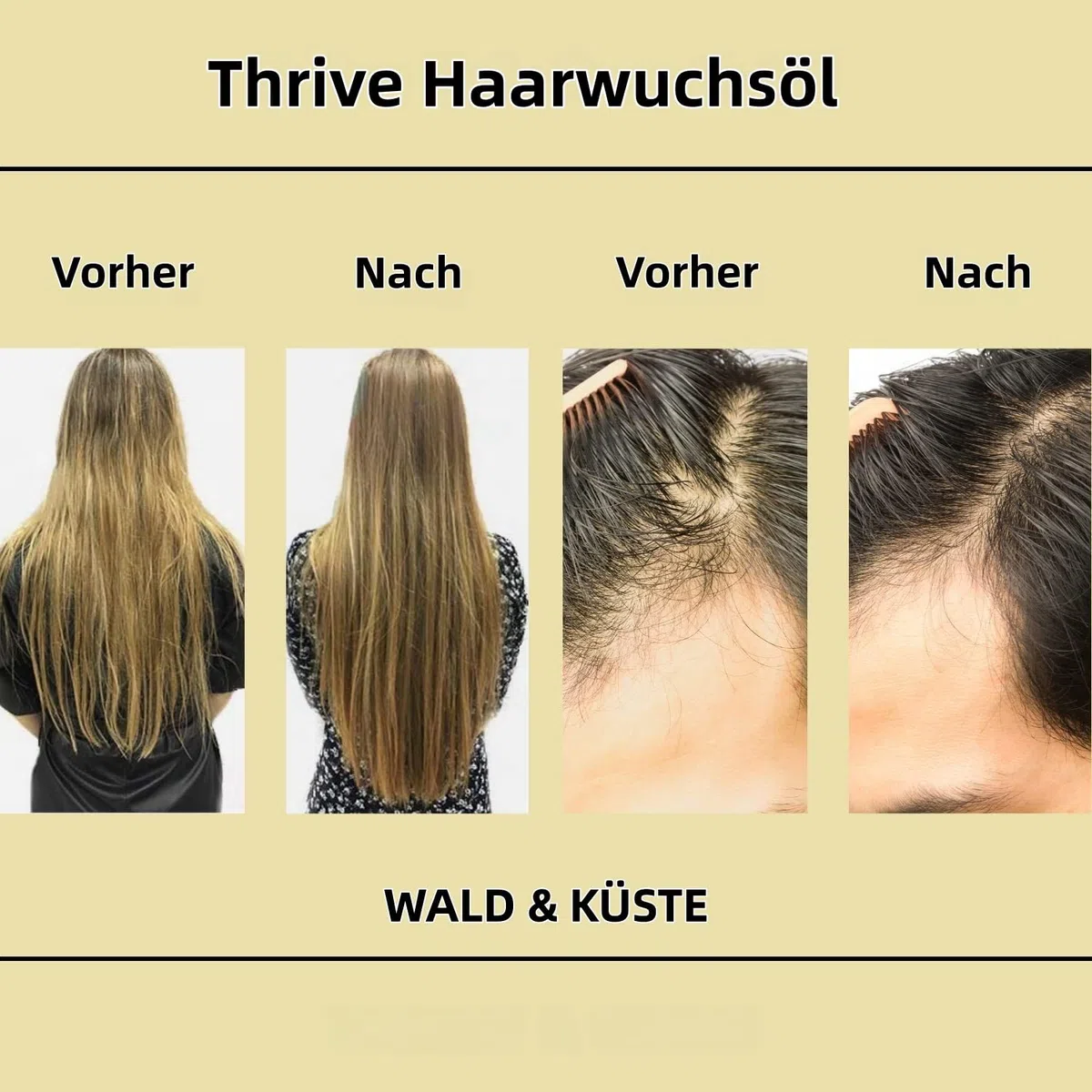 Teluni BabboSow Haaröl-Rosmarin-Haarpflege-Ätherisches Öl (3 Stück)
