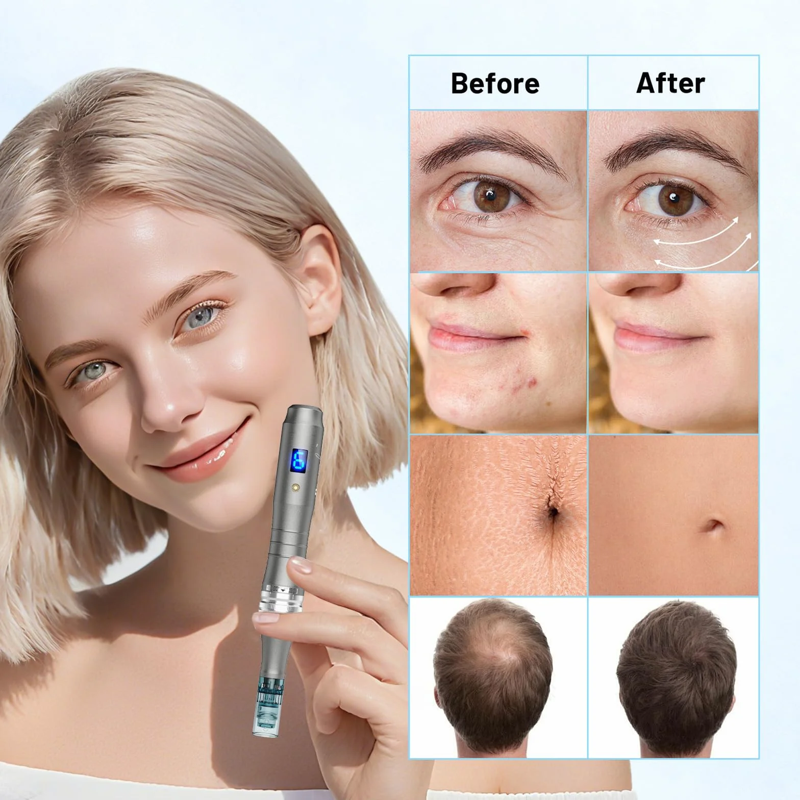 Dr. Pen 2026 Ultima M8 Professioneller Microneedling Pen, Kabellos mit 25 Ersatzkartuschen, 6 Stufen und LED-Anzeige Elektrischer Dermapen für Haarwachstum, Gesicht, Körper und Hautpflege