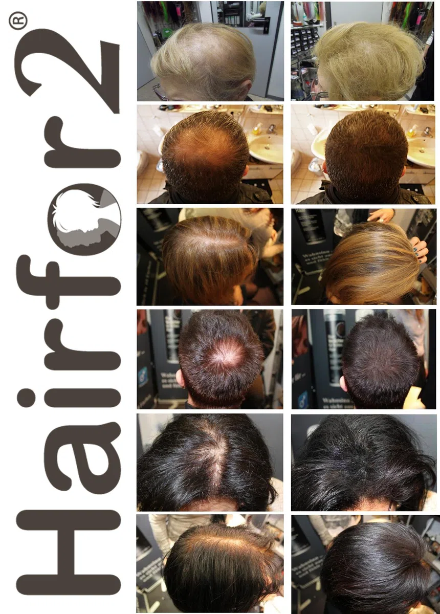Hairfor2 Haarverdichtungsspray gegen lichtes Haar | Haarpuder | Streuhaar | Haarauffüller | Haarausfall | Haarverdichter (300ml, Mittelblond)