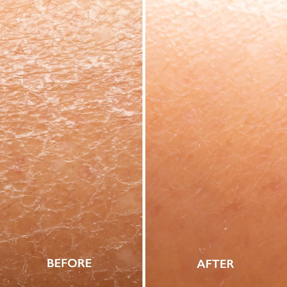 Gatineau - AHA Body Lotion, Duo Pack, feuchtigkeitsspendend für trockene Haut (400 ml x 2 Flaschen) | Hydrating Body Lotion Duo with Shea Butter Hilft trockene Haut mit AHA-Technologie zu peelen, weich zu machen und zu glätten