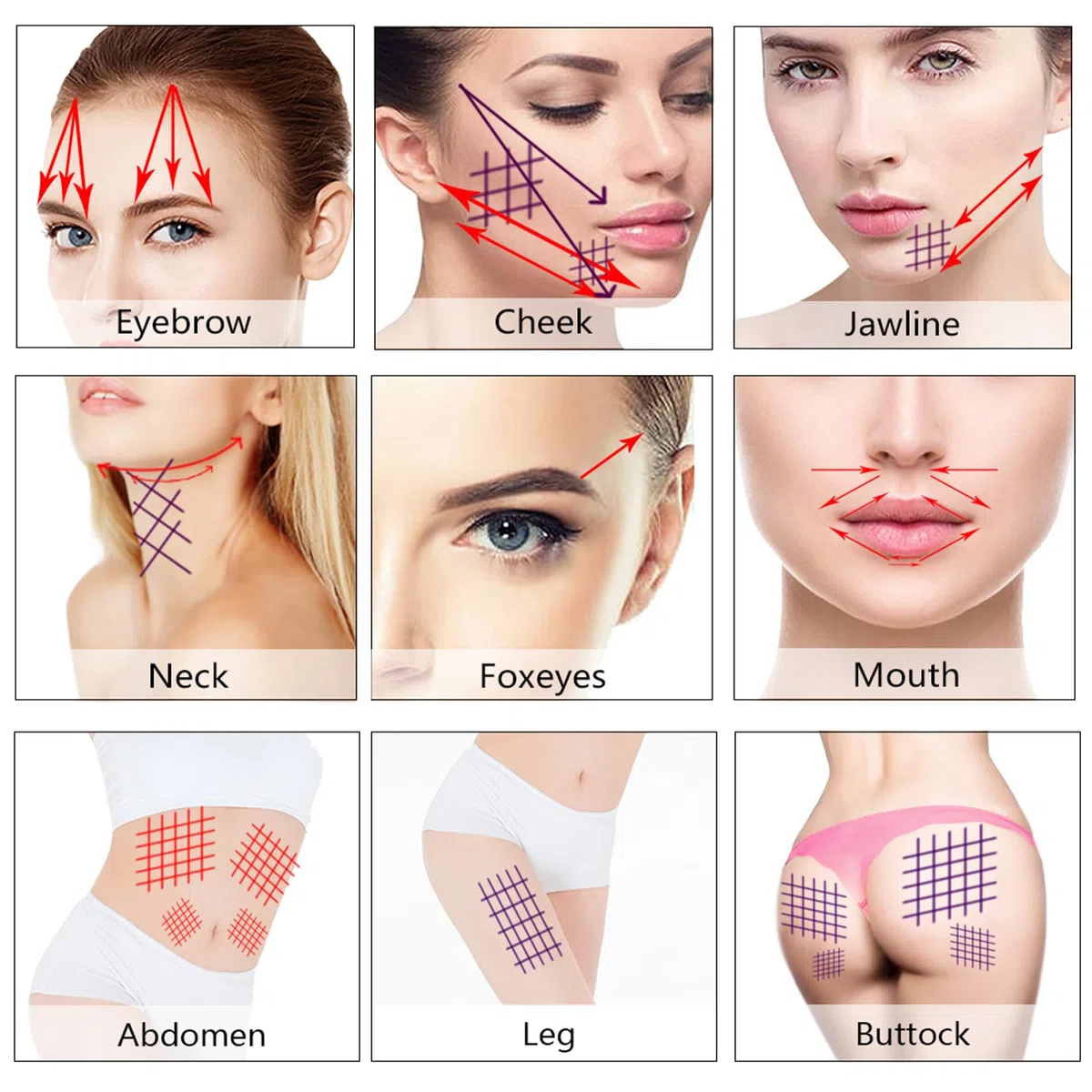 PDO Threads Mono Type Face Lift Whole Body Tightening 100pcs,26G-60MM 29G-38MM 29G-25MM Drei Größenoptionen (29G*38MM)