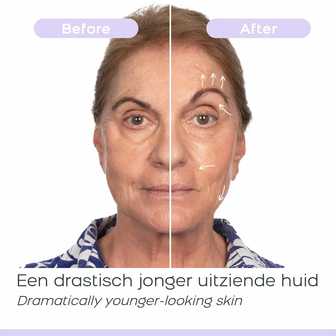 Dermawand Pro Hautpflegegerät Anti-Aging Gesichtspflege Faltenreduzierung Porenverfeinerung Straffung