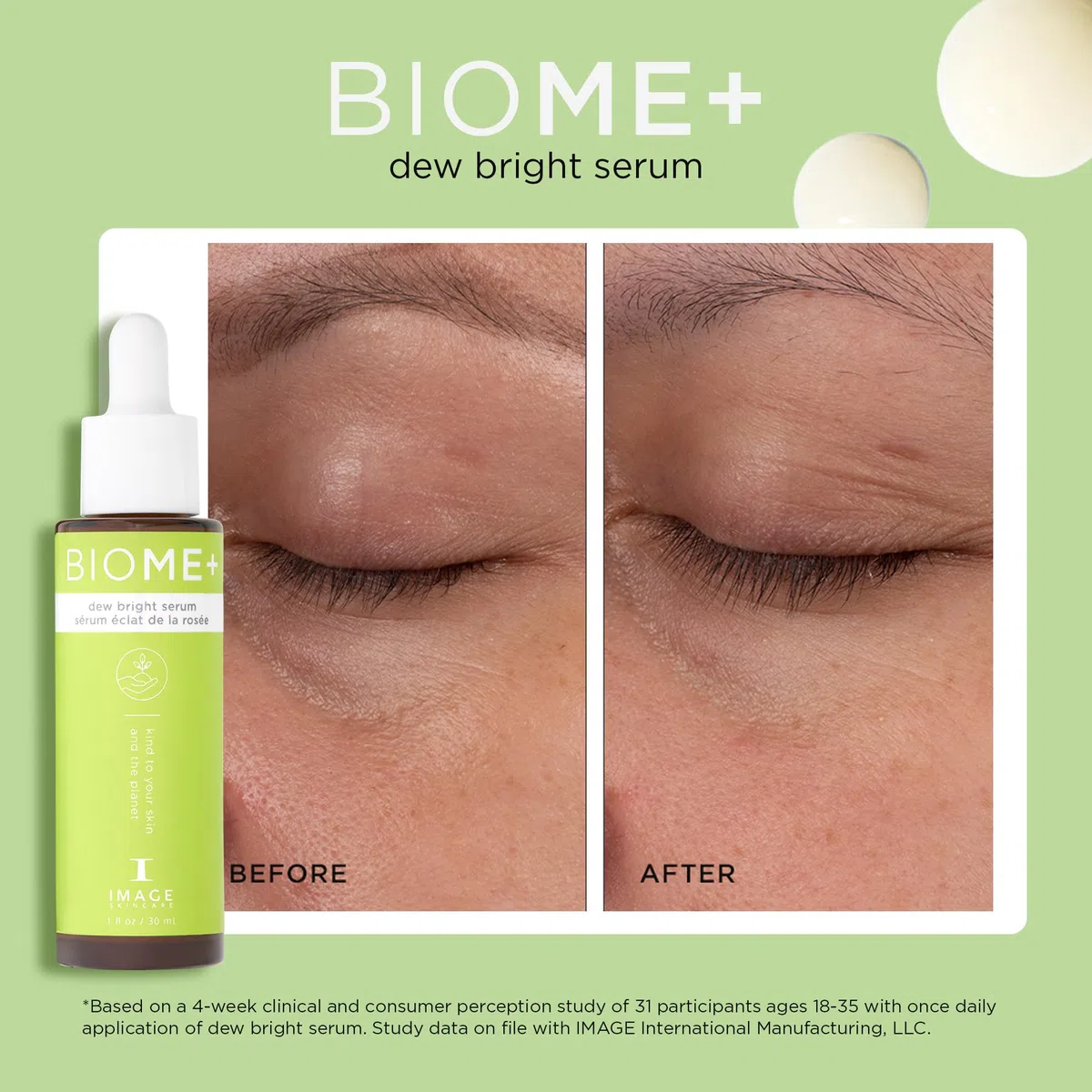 Image Skincare - BIOME+ Dew Bright Serum - 30 ml