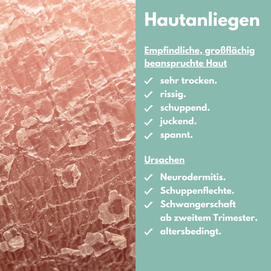 benevi neutral ISO-Lotion 200ml. Bodylotion für sehr trockene, rissige, empfindliche, juckende und schuppende Haut, hinterlässt angenehmen, pflegenden Schutzfilm.