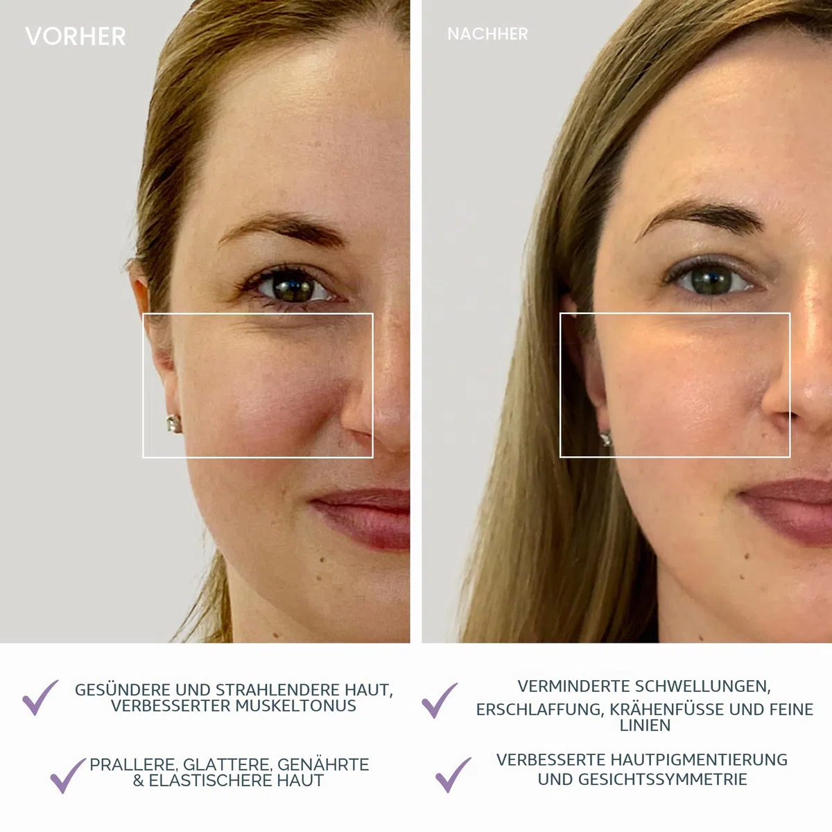 FOREO BEAR mini Gezieltes Mikrostrom-Facelifting-Gerät - Gesichtsmassagegerät gegen falten - Gesicht & Jawline Trainer - Gesichtsmassage - Face lifting gerät-- Anti-Aging - Lavander