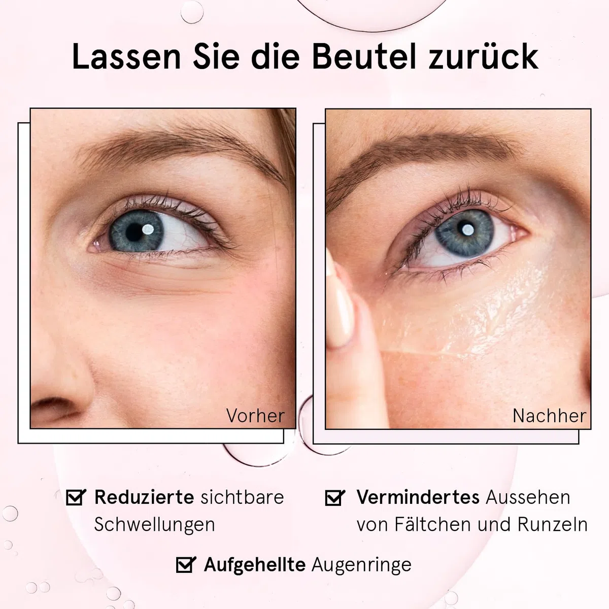 grace & stella, Augenroller mit Augencreme genen Falten und Augenringe mit Retinol & Koffein Augen-Roll-On mit Augencreme gegen Tränensäcke (15ml)