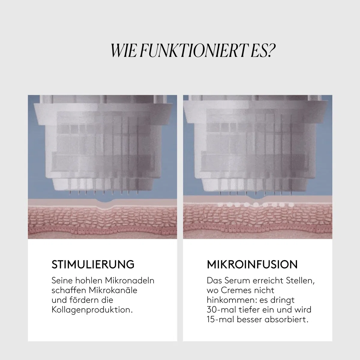 CLINICAL BEAUTY FILLER – Anti-Falten-Behandlung – 1 Anwendung – Fortschrittliche Technologie – Bekämpft Hauterschlaffung – Einfach, Schmerzfrei und Sicher – Mit Hyaluronsäure und Peptiden | Mit Hyaluronsäure, Matrixyl und Argireline, straffend, reduziert
