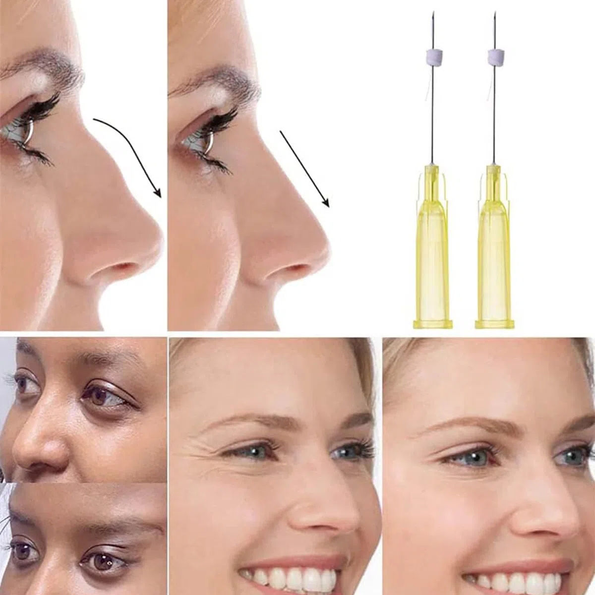 PDO Threads Mono Type Face Lift Whole Body Tightening 100pcs,26G-60MM 29G-38MM 29G-25MM Drei Größenoptionen (29G*38MM)