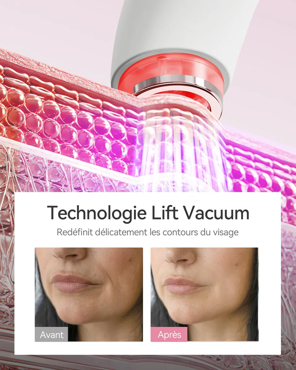 FliKEZE Gesichtsmassagegerät mit Vakuum & Rotlicht, 3-in-1 Beauty Gerät für Gesicht und Hals | Elektrisches Gesichtspflegegerät mit LED-Licht, 3 Intensitätsstufen und einfacher Anwendung für die tägliche Beauty-Routine