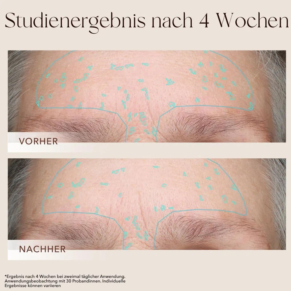 mellow NOIR XTREME Brightening Booster 30ml - Anti Pigmentflecken Serum - Reduziert dunkle Flecken, Altersflecken & Pickelmale im Gesicht und auf der Haut - Vegan - Zertifizierte Naturkosmetik