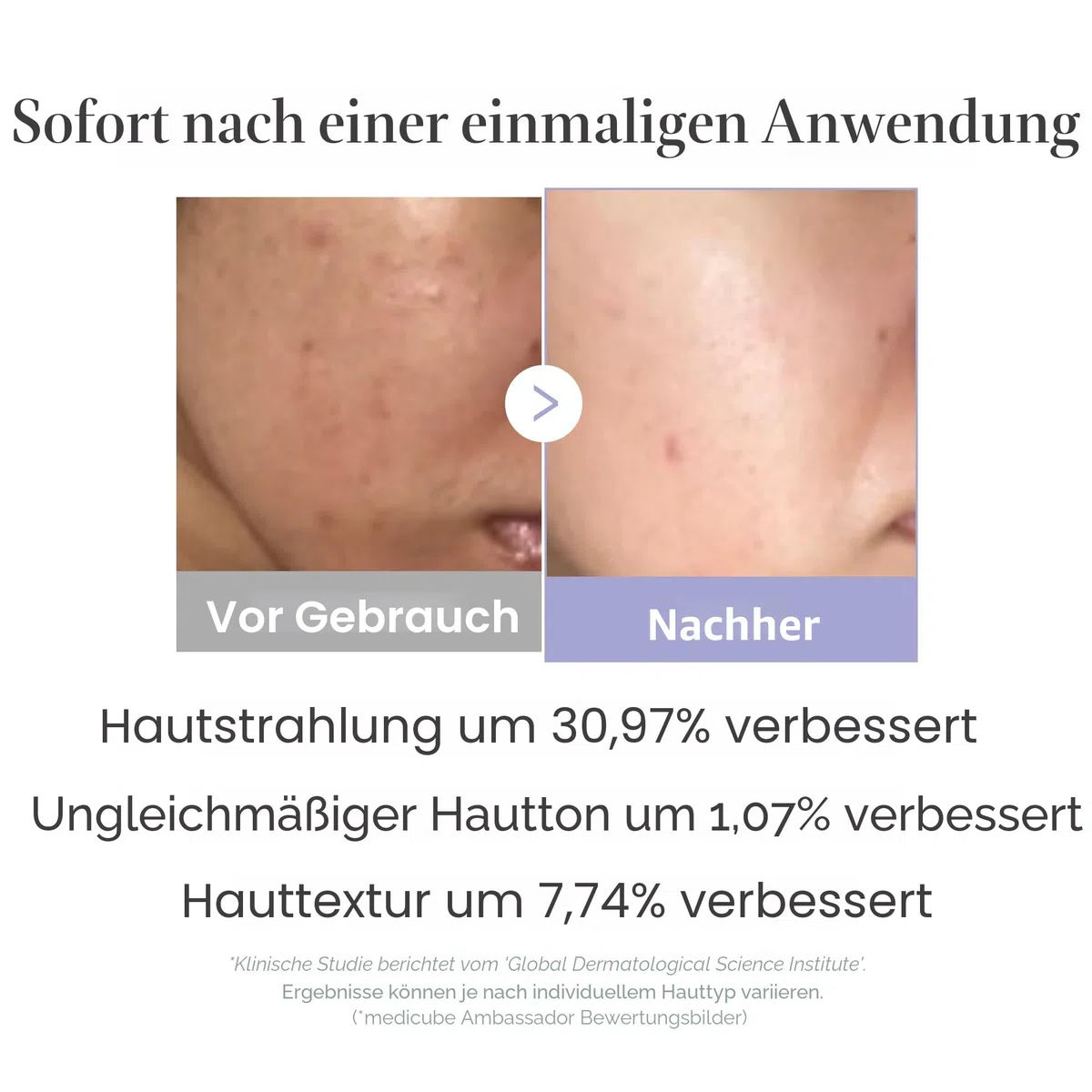 medicube Mini Booster Pro Pink | Günstiges Gesichtspflegewerkzeug für Anfänger – Tragbarer Glow Booster für Glashaut, fördert die Absorption der Hautpflege, Hautpflege für Teenager, koreanische
