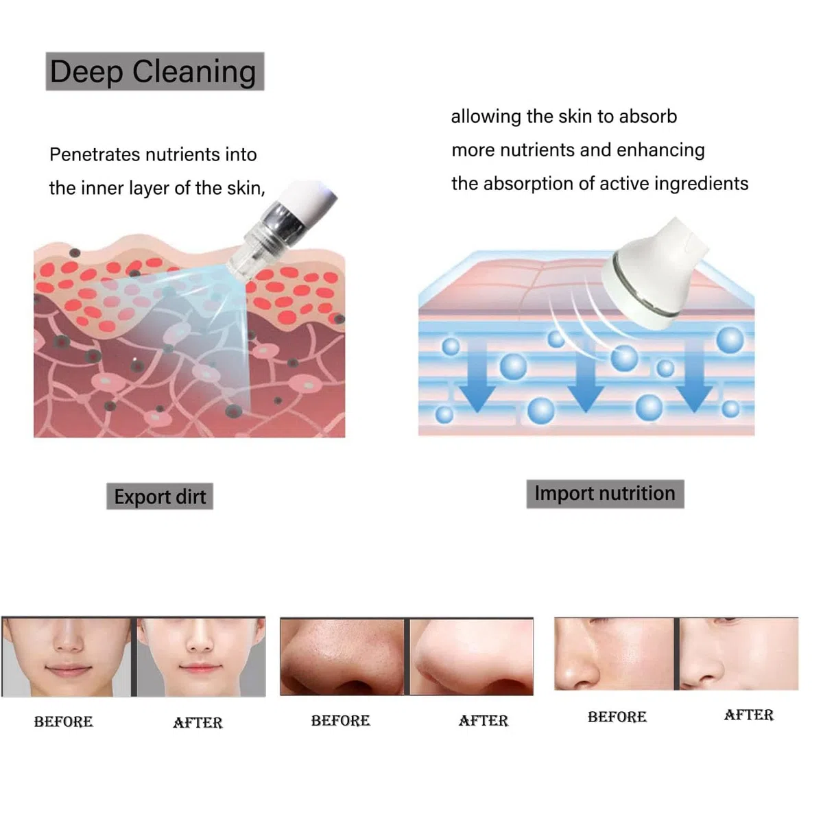 Professionelle Hydroface-Maschine 7-in-1, Hautpflege, Mikrodermabrasion, Peeling, kleines Blasengerät zur Beseitigung von Falten und Mitessern, Dermabrasion für Haus und Salon