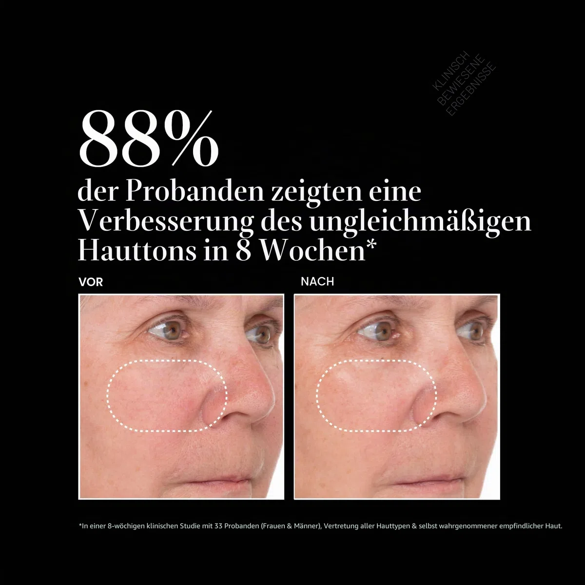 Vitamin C Super Serum Plus, Anti-Aging, Anti-Falten-Gesichtsserum mit Vitamin C, Retinol, Hyaluronsäure, Niacinamid und Salicylsäure, 1 fl oz