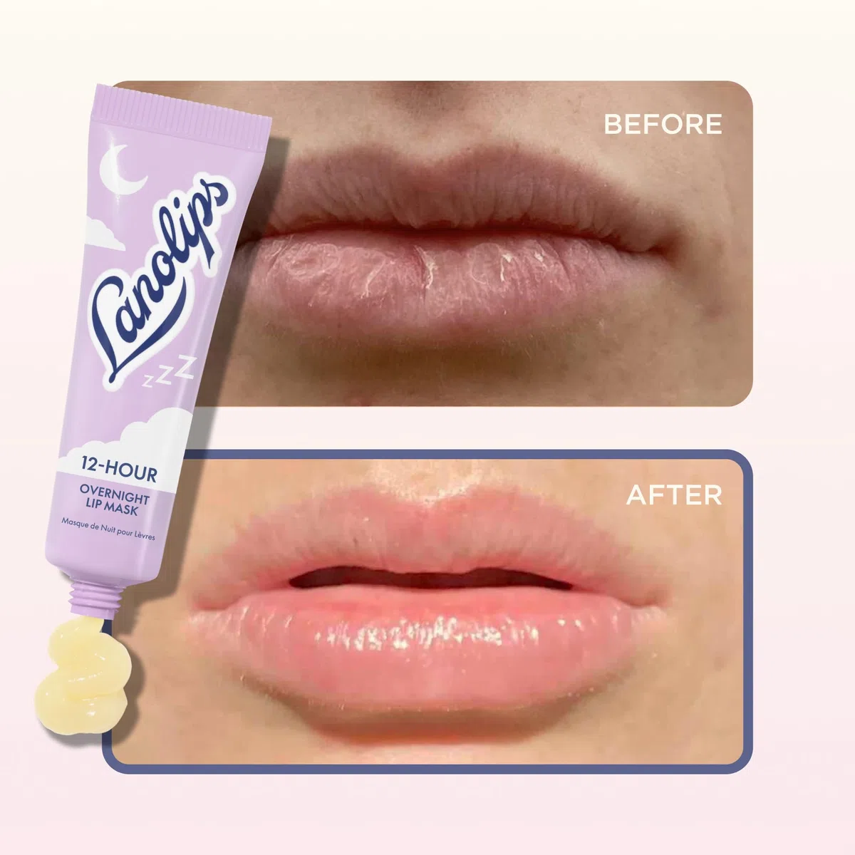 12-Stunden-Übernachtungs-Lippenmaske, reichhaltige Lippen-Feuchtigkeitscreme mit Hyaluronsäure, Vitamin C und Ceramiden, stellt die Lippen wieder her, erweicht und füllt sie auf, während Sie schlafen